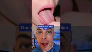 Doctor reacts to genius canker cover dermreacts doctorreacts cankercover [upl. by Ellehcear]