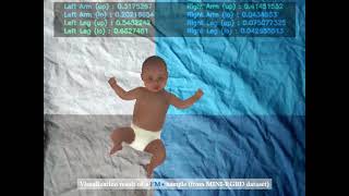 Identification of Abnormal Movements in Infants A DNN for Body Partbased Prediction of CP [upl. by Ano]