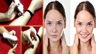 How to use Mole Removal Pen  Skin Tags and Mole removal Pen Demo [upl. by Moraj]