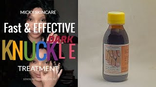 Fade Off Dark Knuckles Fast amp Effective  Fongicide Natural Light  Dark Knuckles Treatment [upl. by Eselahs]