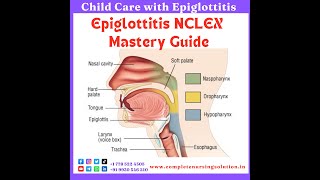 Epiglottitis For NCLEX epiglottitis education nursingexam nclexquestions nclexpreparation eaxm [upl. by Panthea]