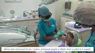 Albirea dintilor cu laser la Clinica EXCEDENT [upl. by Ijneb]