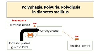 Polyuria Polyphagia Polydipsia in Diabetes mellitus [upl. by Neeroc]