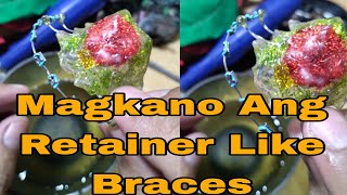 Magkano Ang Retainer Like Braces price Philippines [upl. by Yrrem]