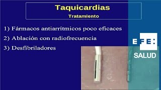 Tratamiento de las arritmias de taquicardia fármacos ablación y desfibrilador [upl. by Dasya]