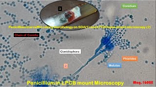 Penicillium marneffei colony morphology on SDA and LPCB tease mount Microscopy [upl. by Concepcion]