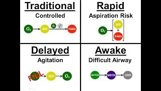 Introduction to Intubation  01  Approach Sequence [upl. by Leahcam123]