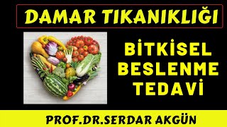 Damar Tıkanıklığı Bitkisel Tedavi ile Açılır mı Bitkiler Damar Tıkanıklığı Tedavisi [upl. by Adnirual]