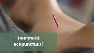 Hoe werkt acupunctuur [upl. by Sheppard]