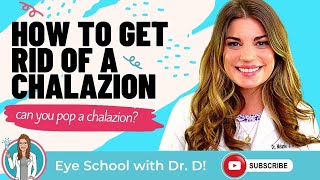 Chalazion Treatment Options  Getting Rid of Eye Chalazions [upl. by Anyar]