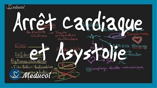 Arrêt cardiaque et Asystolie ECG causes et traitement ictal [upl. by Ogaitnas144]