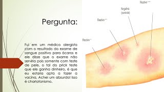 Fiz exame de sangue e deu positivo para Ácaros  O médico disse que só o exame Prick Test serviria [upl. by Aziar]