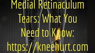 Medial Retinaculum Tears What You Need to Know httpskneehurtcom [upl. by Sirovaj]