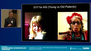 ADAPT vs SOLUMBRA vs BGC Thrombectomy When to use what technique [upl. by Nylorac227]