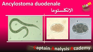 Ancylostoma duodenale  Hookworm الديدان الخطافية واذاى بتسبب انيميا نقص الحديد [upl. by Casimir]