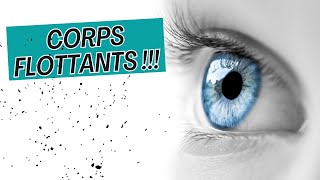 Adieu Corps Flottants Mouches Volantes Points Noirs  4 étapes pour les éliminer  👋👁️ [upl. by Eninnaj]