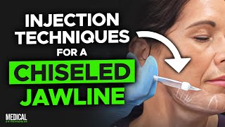 How to Get Rid of Jowls with Filler  Full Procedure Demonstration [upl. by Lory848]