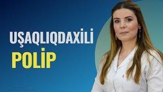 Poliplərin Hamiləliyin Baş Tutmasına Təsiri [upl. by Dombrowski952]