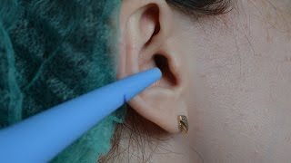 Серная пробка Удаление в домашних условиях Ear wax Removal at home [upl. by Nwahshar580]