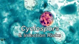 Cyclospora amp Infection Risks [upl. by Bradlee992]