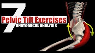 What is Anterior Pelvic Tilt Posture [upl. by Zumstein]