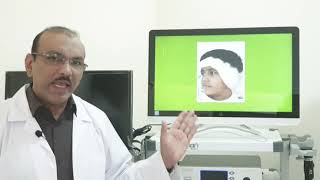 Acute mastoiditis Part 2 Hindi Patient teaching programme [upl. by Bonina]