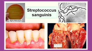 Streptococcus sanguinis [upl. by Elreath]