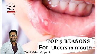 TOP 3 REASONS FOR ULCERS IN MOUTH  मुह के घाव होने के टॉप 3 कारण। जलन से कैसे मुक्ति मिले [upl. by Renell94]