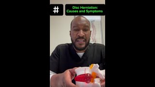 Disc Herniation Pearland [upl. by Austine]