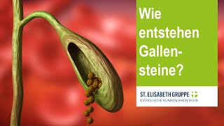 Wie entstehen Gallensteine [upl. by Anirrok88]