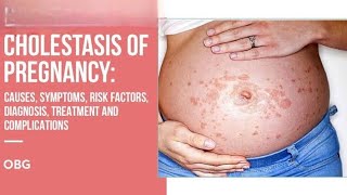 cholestasis in Pregnancy CIP [upl. by Katalin285]