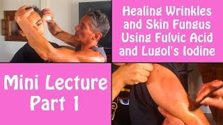 Healing Wrinkles and Skin Fungus Using Fulvic Acid and Lugols Iodine Part 1  Dr Robert Cassar [upl. by Eatnoid]