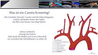 Carotis Sceenings TrainingsZentrum UltraschallDiagnostik [upl. by Acirederf]