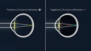 How to correct longitudinal chromatic aberration LCA [upl. by Esta721]