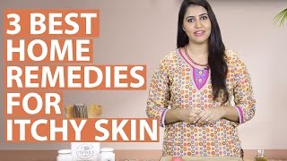 3 Best Home Remedies To Get Rid Of ITCHY SKIN ALLERGIES Naturally [upl. by Ridgley]