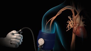 High Blood Pressure  Hypertension  Nucleus Health [upl. by Weasner279]