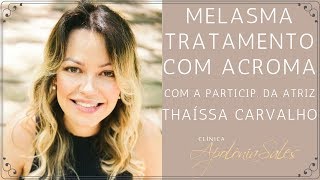 Tratamento contra o melasma com o laser Acroma [upl. by Alithia598]