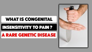 What is Congenital insensitivity to pain A Rare Genetic Disease [upl. by Aneekahs]