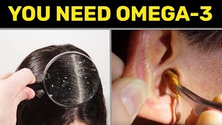 10 Signs Your Body Is Begging For Omega3 [upl. by Toolis220]