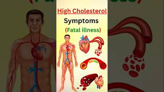 STOP Ignoring These Warning Signs of High Cholesterol [upl. by Anrol]