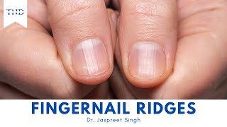 Do You Have Vertical Ridges On Your Fingernails Heres What They Mean [upl. by Egnalos]