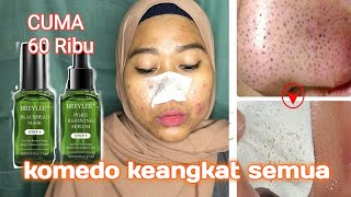 REVIEW MASKER KOMEDO VIRAL BREYLEE BLACKHEAD MASK DAN PORE REFINING SERUM [upl. by Larine]