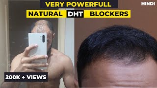 Very Powerful Natural DHT Blockers that will Stop Hair Loss in 2022 [upl. by Castara]