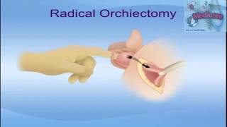 Orchidectomy orchiectomy theory [upl. by Inig]