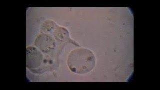 Trichomonas hominis con Blastocystis fagocitados e intento de fagocitosis de otro [upl. by Annais]