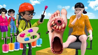 Scary Teacher 3D vs Squid Game Feet Treatment or Error 5 Time Challenge [upl. by Sabba202]