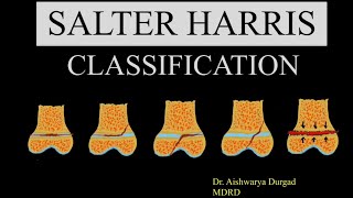 SALTER HARRIS CLASSIFICATION for physeal injuries  Xray amp illustrations with explanation [upl. by Birck974]