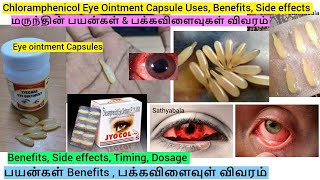 Conjunctivitis treatment [upl. by Saberhagen]