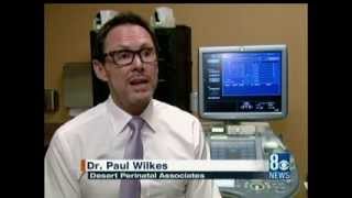 Dr Paul Wilkes Discusses Cell Free DNA in High Risk Pregnancies [upl. by Kamat]