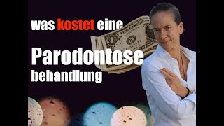 ParodontitisBehandlung was KOSTET das [upl. by Anthe]